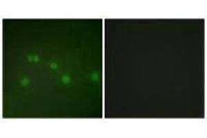 Immunofluorescence analysis of HUVEC cells, using COT2 antibody. (NR2F2 anticorps  (N-Term))