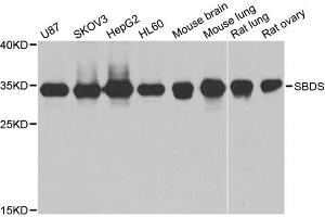 Western blot analysis of extracts of various cell lines, using SBDS antibody (ABIN1980243) at 1:1000 dilution.