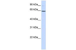 WB Suggested Anti-LTA4H Antibody Titration: 0. (LTA4H anticorps  (Middle Region))