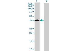 Western Blot analysis of MECR expression in transfected 293T cell line by MECR MaxPab polyclonal antibody. (MECR anticorps  (AA 1-373))