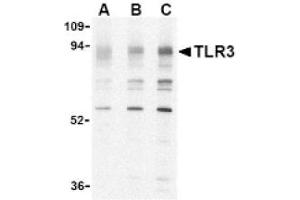 Image no. 1 for anti-Toll-Like Receptor 3 (TLR3) (N-Term) antibody (ABIN265140) (TLR3 anticorps  (N-Term))