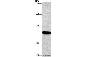 Western blot analysis of Hela cell, using CTGF Polyclonal Antibody at dilution of 1:850 (CTGF anticorps)