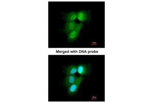 ICC/IF Image Immunofluorescence analysis of paraformaldehyde-fixed A431, using 20S Proteasome alpha6 , antibody at 1:200 dilution.
