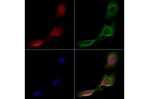 ABIN6261240 and ABIN6266855 staining Hela cells by IF/ICC. (DCP1A anticorps  (Internal Region))