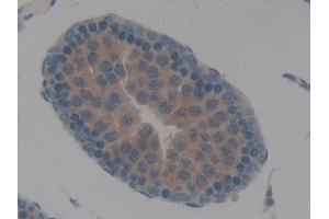 Detection of TBX21 in Rat Testis Tissue using Polyclonal Antibody to T-Box Protein 21 (TBX21)