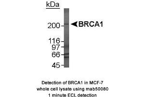 Image no. 3 for anti-Breast Cancer 1 (BRCA1) (AA 1314-1600), (AA 1314-1864) antibody (ABIN363234)