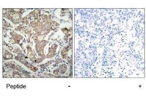 Image no. 1 for anti-BCL2-Associated Agonist of Cell Death (BAD) (Ser155) antibody (ABIN197213) (BAD anticorps  (Ser155))