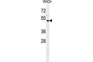 Western blot analysis in WiDr cell line lysates (35ug/lane) using CD121b / IL1R2  Antibody . (IL1R2 anticorps  (Middle Region))