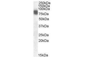 Image no. 1 for anti-Cortactin (CTTN) (N-Term) antibody (ABIN374140) (Cortactin anticorps  (N-Term))