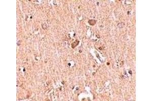Immunohistochemistry (IHC) image for anti-Mediator Complex Subunit 28 (MED28) (Middle Region) antibody (ABIN1031001) (MED28 anticorps  (Middle Region))