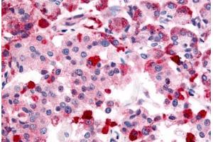 Anti-TRPM4 antibody  ABIN1049433 IHC staining of human pancreas. (TRPM4 anticorps  (Internal Region))
