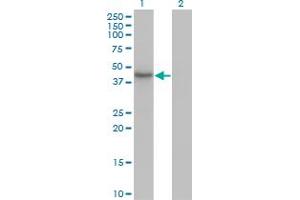 Western Blot analysis of HDAC11 expression in transfected 293T cell line by HDAC11 monoclonal antibody (M01), clone 1C2-2G5.