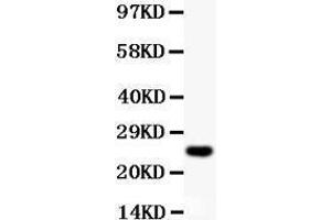 Anti-Cyclin D3 Picoband antibody,  All lanes: Anti Cyclin D3  at 0.