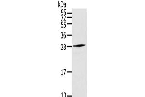 Western Blot analysis of Human fetal muscle tissue using THYN1 Polyclonal Antibody at dilution of 1/800 (THYN1 anticorps)