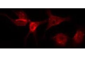 ABIN6275972 staining Hela by IF/ICC. (Angiotensin II Type-1 Receptor anticorps  (N-Term))