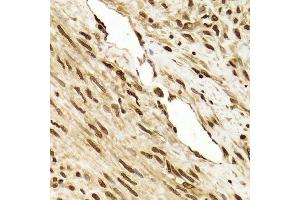 Immunohistochemistry of paraffin-embedded human leiomyoma of uterus using ANP32A Antibody. (PHAP1 anticorps  (AA 1-170))