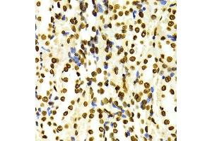 Immunohistochemistry of paraffin-embedded Rat kidney using DiMethyl-Histone H3-K27 antibody.