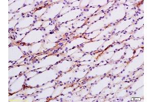 Formalin-fixed and paraffin embedded rat kidney tissue labeled with Anti-ENaCg/γENaC Polyclonal Antibody, Unconjugated at 1:200 followed by conjugation to the secondary antibody and DAB staining