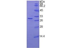 SDS-PAGE analysis of Human Fucosyltransferase 4 Protein. (CD15 Protéine)