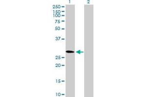 Western Blot analysis of CMTM2 expression in transfected 293T cell line by CMTM2 MaxPab polyclonal antibody. (CMTM2 anticorps  (AA 1-248))