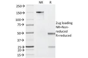 SDS-PAGE Analysis Purified Granzyme B Mouse Monoclonal Antibody (GZMB/2403). (GZMB anticorps  (AA 73-187))