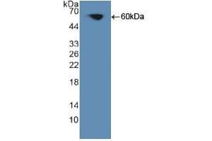 Figure. (PKC theta anticorps  (AA 380-634))