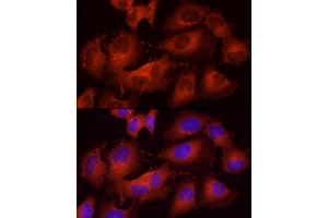 Immunofluorescence analysis of HeLa using Cortactin antibody (ABIN6127722, ABIN6139243, ABIN6139244 and ABIN6221478) at dilution of 1:25 (40x lens).