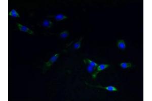 Immunofluorescent analysis of NIH/3T3 cells using ABIN7170878 at dilution of 1:100 and Alexa Fluor 488-congugated AffiniPure Goat Anti-Rabbit IgG(H+L) (TACR1 anticorps  (AA 1-29))