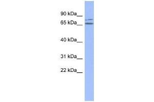 ZNF791 antibody used at 0. (ZNF791 anticorps  (Middle Region))