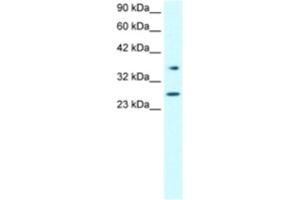 Western Blotting (WB) image for anti-Forkhead Box A3 (FOXA3) antibody (ABIN2460328)