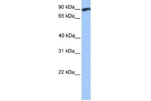 WB Suggested Anti-WDFY3 Antibody Titration:  0. (WDFY3 anticorps  (C-Term))