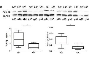 Expression of peroxisome proliferator-activated receptor-gamma coactivator-1 β (PGC-1β) is over-expressed in rheumatoid arthritis (RA)-fibrolast-like synoviocytes (FLS).