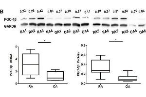 Expression of peroxisome proliferator-activated receptor-gamma coactivator-1 β (PGC-1β) is over-expressed in rheumatoid arthritis (RA)-fibrolast-like synoviocytes (FLS). (PPARGC1B anticorps  (AA 901-1023))