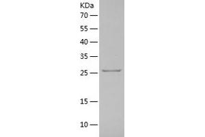 Western Blotting (WB) image for Kallikrein 2 (KLK2) (AA 25-261) protein (His tag) (ABIN7123661) (Kallikrein 2 Protein (KLK2) (AA 25-261) (His tag))