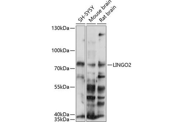 LINGO2 anticorps  (AA 370-540)