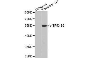Western Blotting (WB) image for anti-Tumor Protein P53 (TP53) (pSer6) antibody (ABIN1870678) (p53 anticorps  (pSer6))