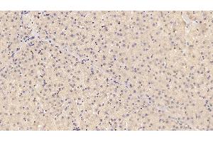 Detection of ADPN in Porcine Liver Tissue using Monoclonal Antibody to Adiponectin (ADPN)
