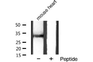 Western blot analysis of FAS ligand Antibody expression in mouse heart tissue lysates. (FASL anticorps  (Internal Region))