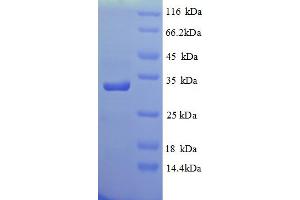 SDS-PAGE (SDS) image for Glutamate Receptor, Ionotropic, N-Methyl D-Aspartate 2a (GRIN2A) (AA 501-750), (partial) protein (His tag) (ABIN5712888)