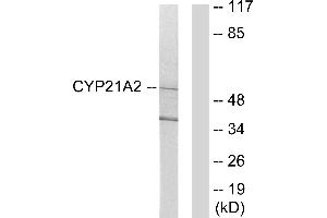 Western blot analysis of extracts from 293 cells, using Cytochrome P450 21A2 antibody. (CYP21A2 anticorps)