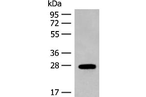 Western blot analysis of Mouse eye tissue lysate using GUCA1B Polyclonal Antibody at dilution of 1:500 (GUCA1B anticorps)