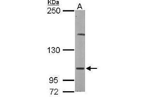 WB Image Sample (50 ug of whole cell lysate) A: Mouse brain 5% SDS PAGE antibody diluted at 1:500