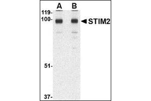 Western blot analysis of STIM2 in A-20 cell lysate AP30838PU-N at (A) 0.