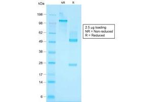 SDS-PAGE analysis of purified, BSA-free recombinant Basic Cytokeratin antibody (clone KRTH/1576R) as confirmation of integrity and purity. (Recombinant Keratin Basic anticorps)