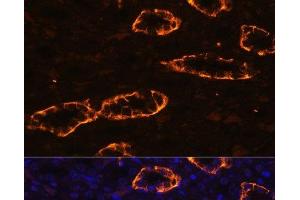 Immunofluorescence analysis of Rat kidney using AQP3 Polyclonal Antibody at dilution of 1:100. (AQP3 anticorps)