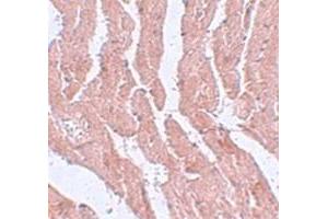 Immunohistochemical staining of mouse heart tissue with LZTR1 polyclonal antibody  at 5 ug/mL dilution.