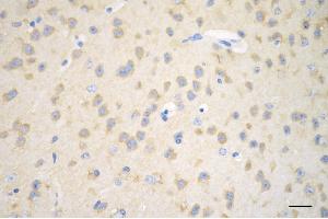 Immunohistochemistry was performed on paraffin-embedded mouse brain using huntingtin antibody (ABIN7799005), 1:200). (Recombinant Huntingtin anticorps)