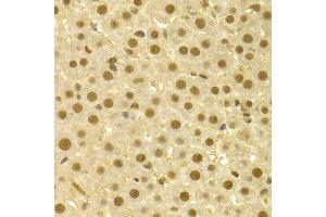 Immunohistochemistry of paraffin-embedded rat liver using CDC25A antibody (ABIN5970519) at dilution of 1/100 (40x lens). (CDC25A anticorps)