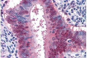 Human Uterus: Formalin-Fixed, Paraffin-Embedded (FFPE)