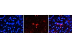 Rabbit Anti-CLN6 Antibody     Formalin Fixed Paraffin Embedded Tissue: Human Pineal Tissue  Observed Staining: Cytoplasmic in cell bodies of pinealocytes  Primary Antibody Concentration: 1:100  Other Working Concentrations: 1/600  Secondary Antibody: Donkey anti-Rabbit-Cy3  Secondary Antibody Concentration: 1:200  Magnification: 20X  Exposure Time: 0. (CLN6 anticorps  (C-Term))